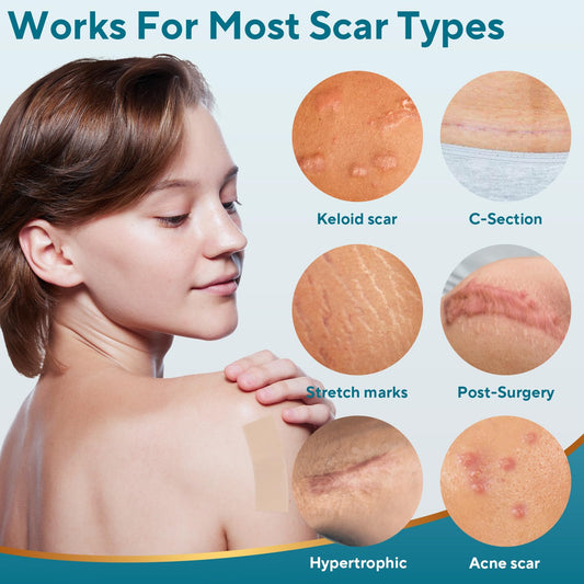 GIATENL silicone scar tape packaging highlights reusable scar care you can apply at home.