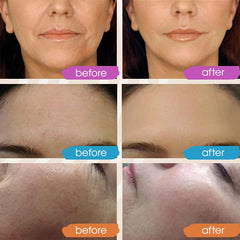 GLEOW Vitamin C Serum being applied to the face for absorption