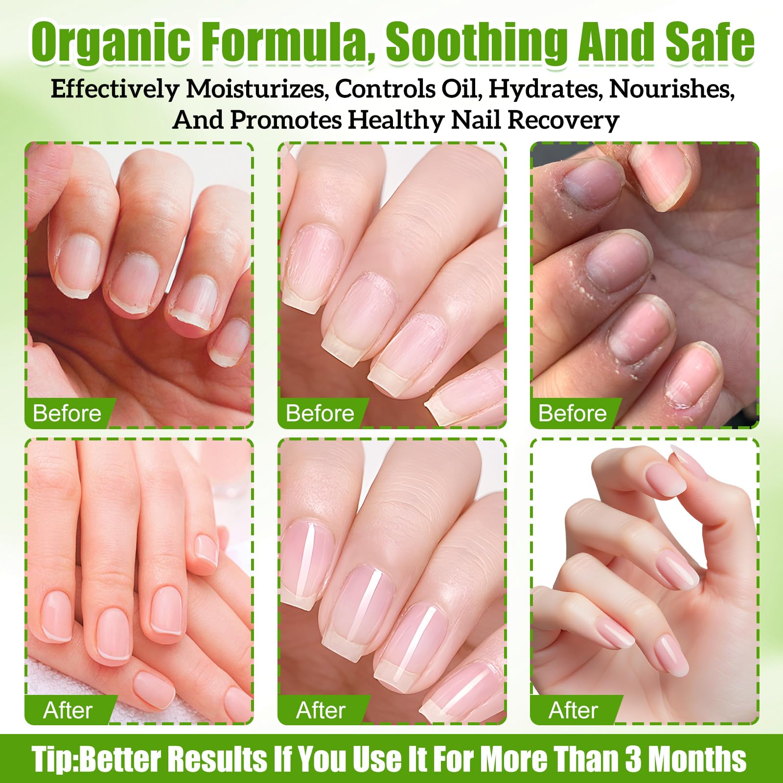 Glimmerella nail growth serum twist in use, easy daily application.