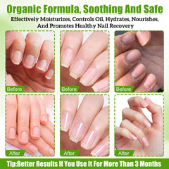 Glimmerella nail growth serum twist in use, easy daily application.