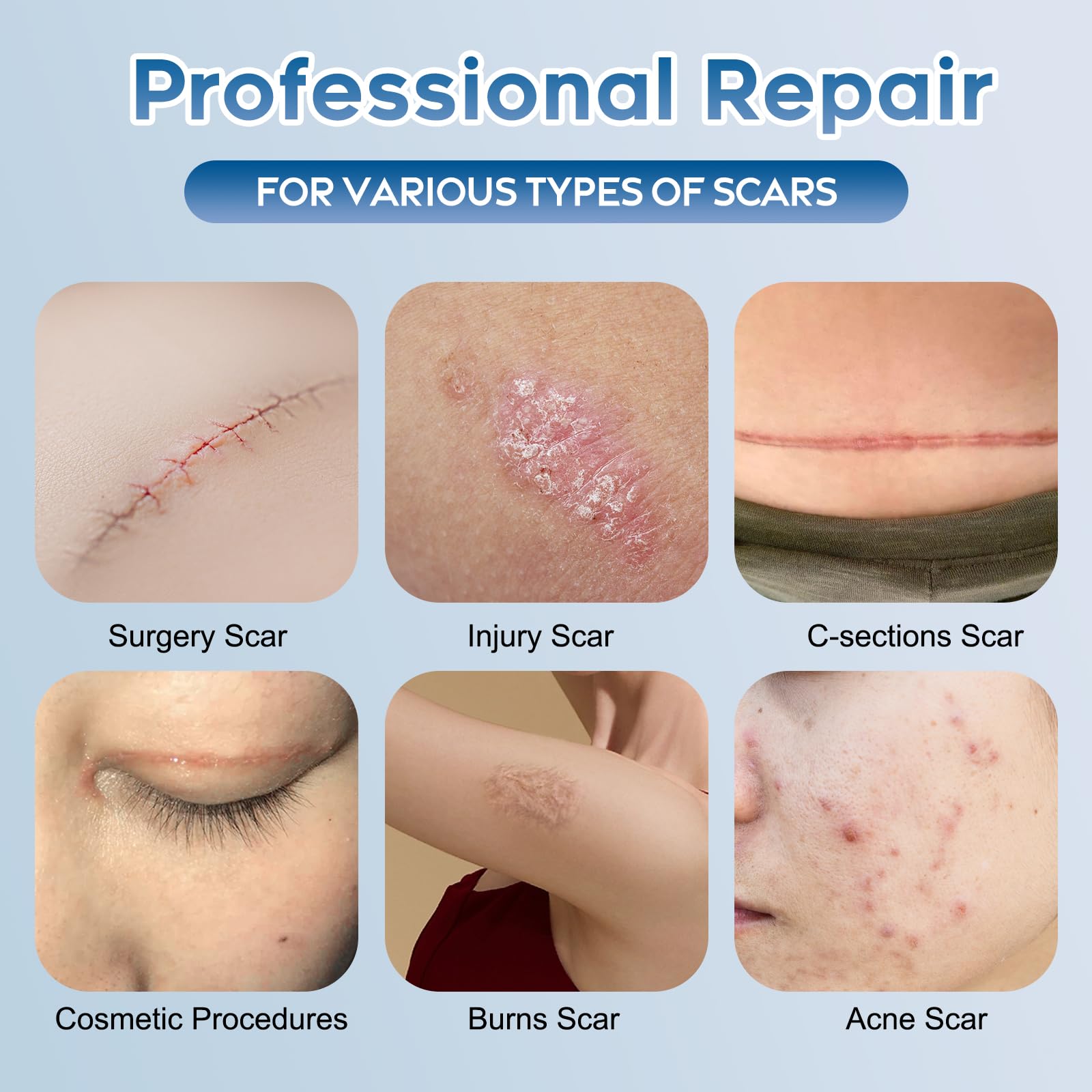 Glowor silicone scar gel texture closeup highlights smooth application and hydration.