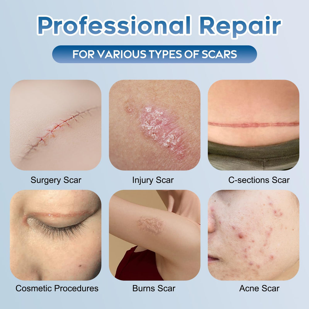 Glowor silicone scar gel texture closeup highlights smooth application and hydration.