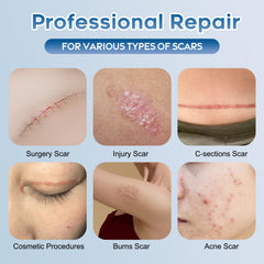 Glowor silicone scar gel texture closeup highlights smooth application and hydration.