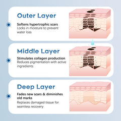 Glowor silicone scar gel before-after emphasizes potential improvements with consistent use.
