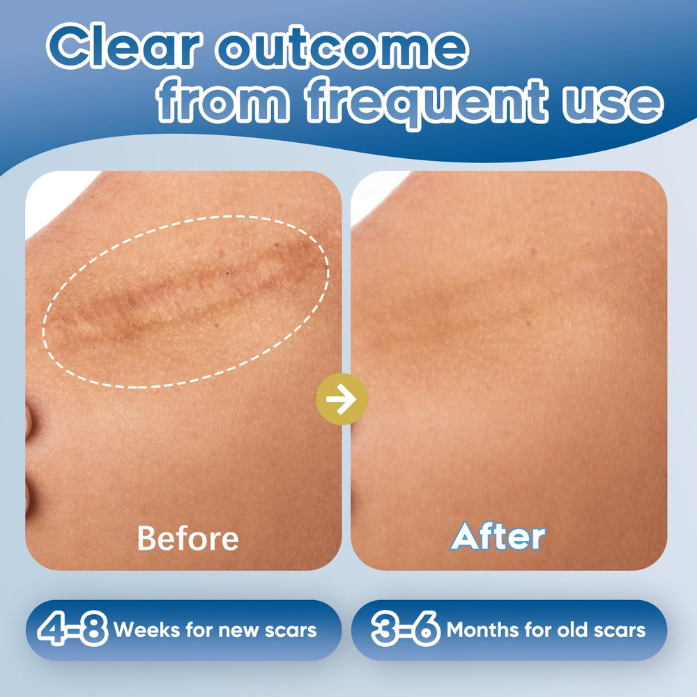 Glowor silicone scar gel ingredient-label closeup communicates fragrance-free formulation.