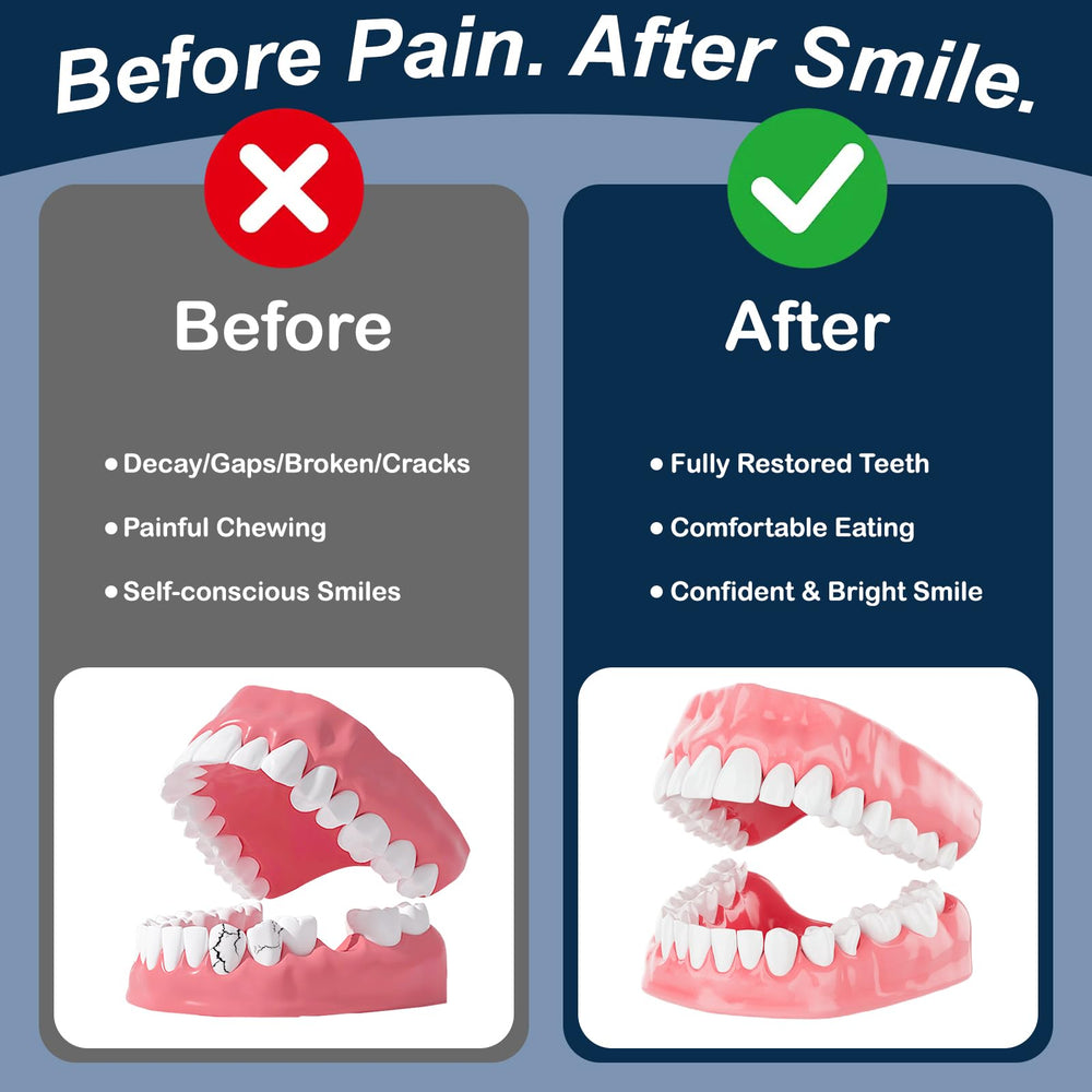 Glue ring holders used in denture repair