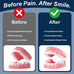 Glue ring holders used in denture repair