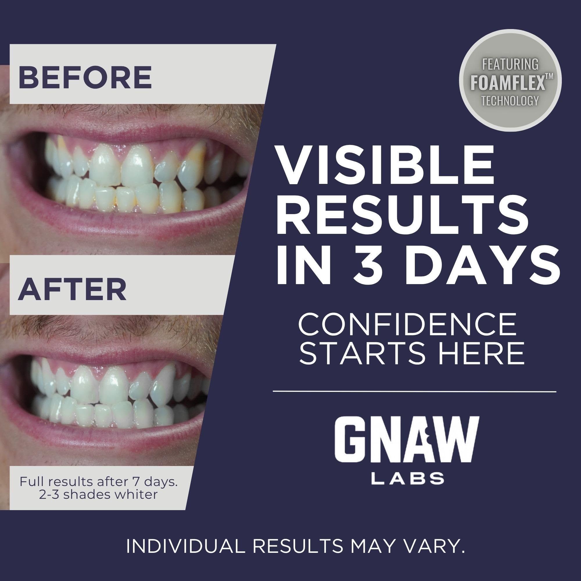 Enamel-safe whitening strips with mint extract and natural ingredients