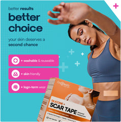 GoGleefy silicone scar sheets roll designed for keloids, can help flatten appearance