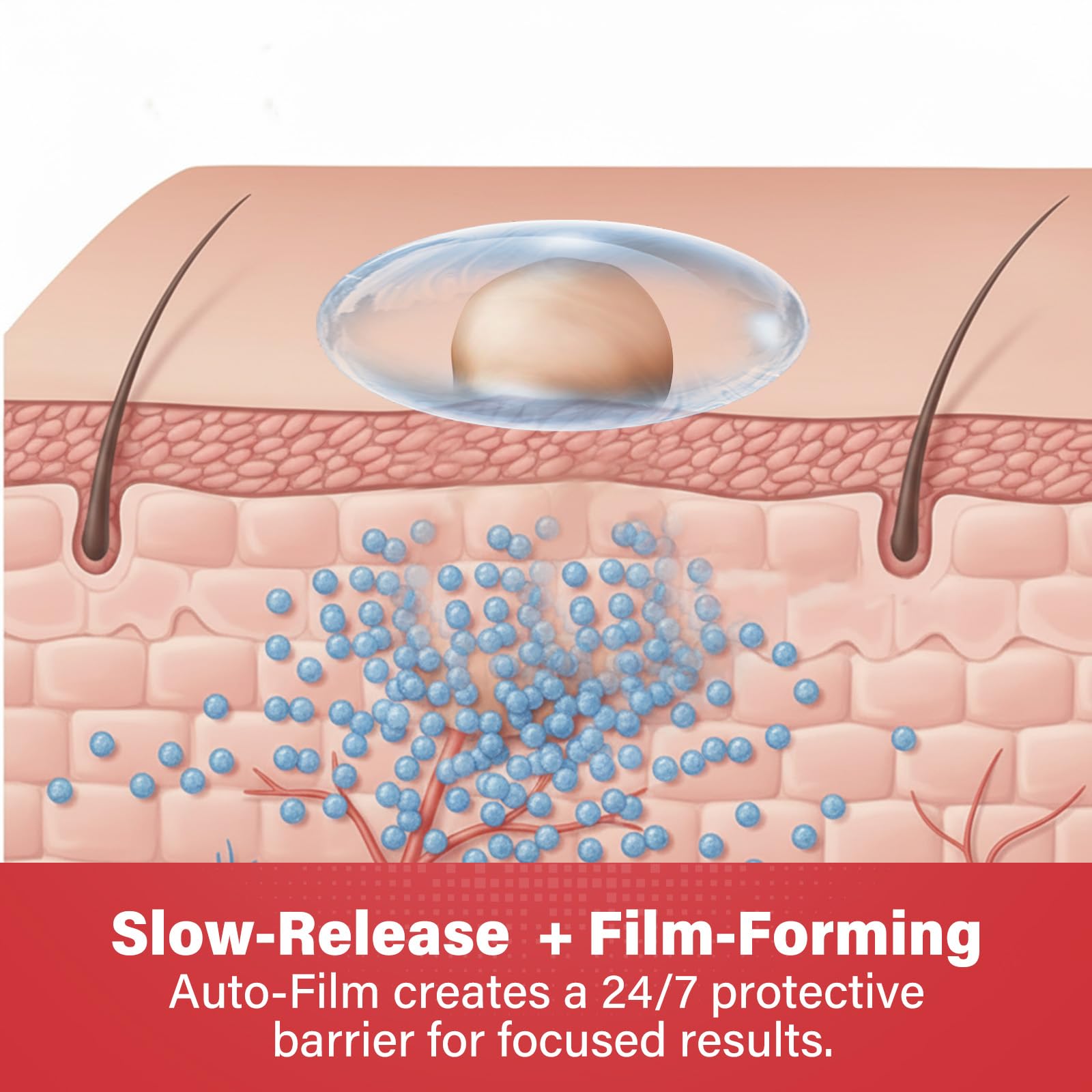 Goodnites wart remover drying process after application on skin.