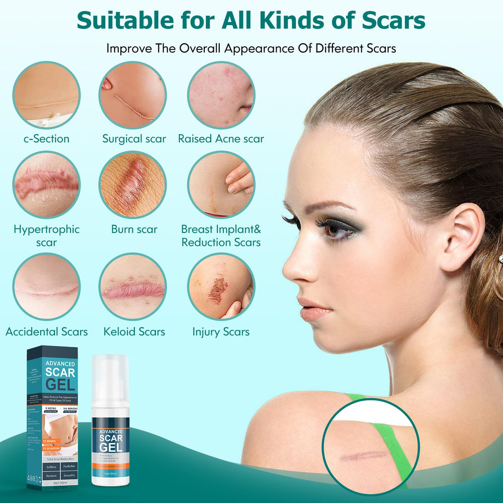 Gowgaw Scar Gel used on face and body for scar care benefits
