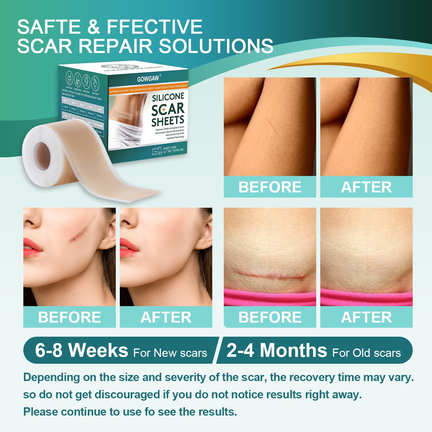 Gowgaw silicone scar tape latex-free — safe for all ages and sensitive skin.