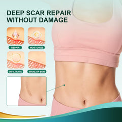 Gowgaw silicone scar tape washable and reusable — durable, long-lasting scar management.