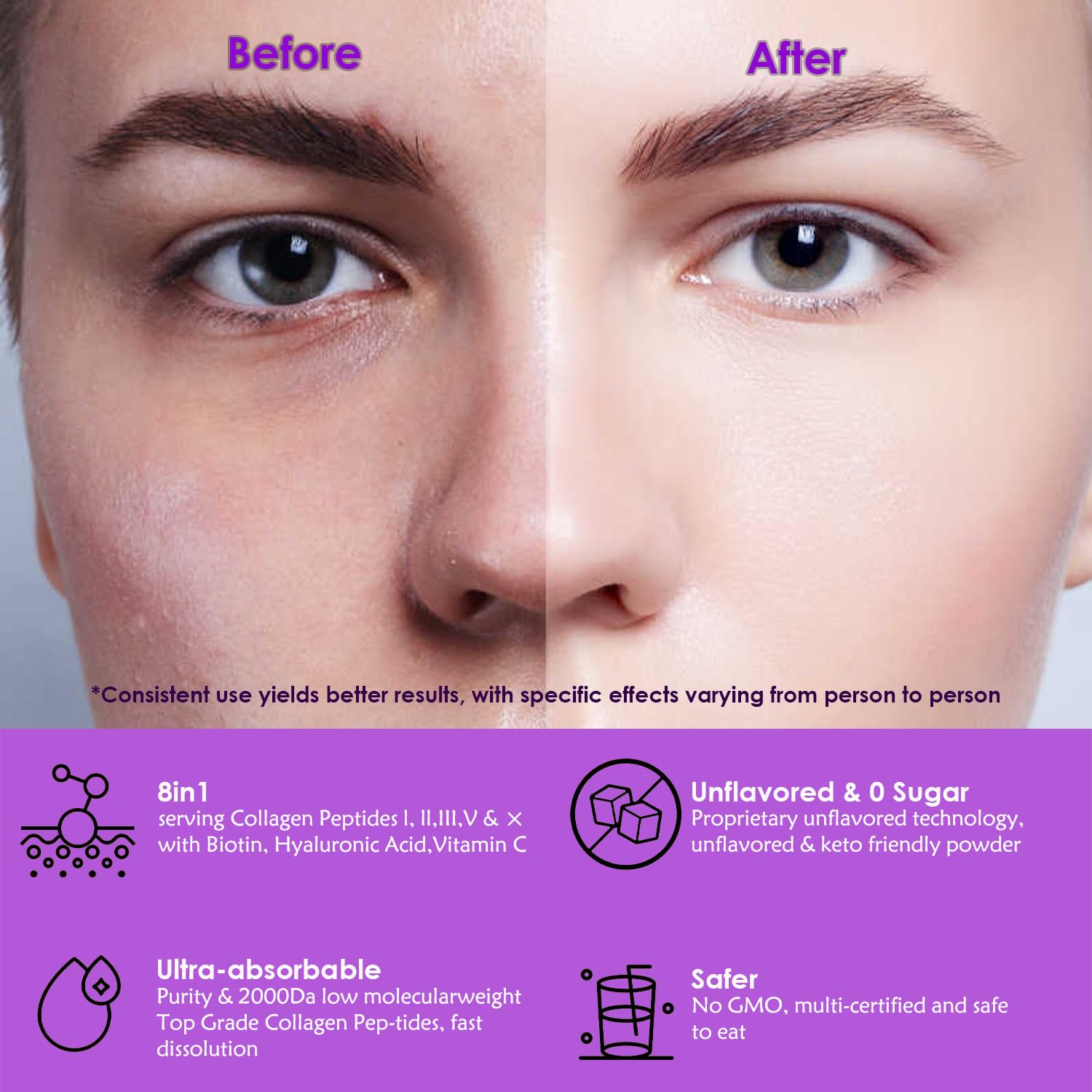 Collagen peptides Types I–X blend