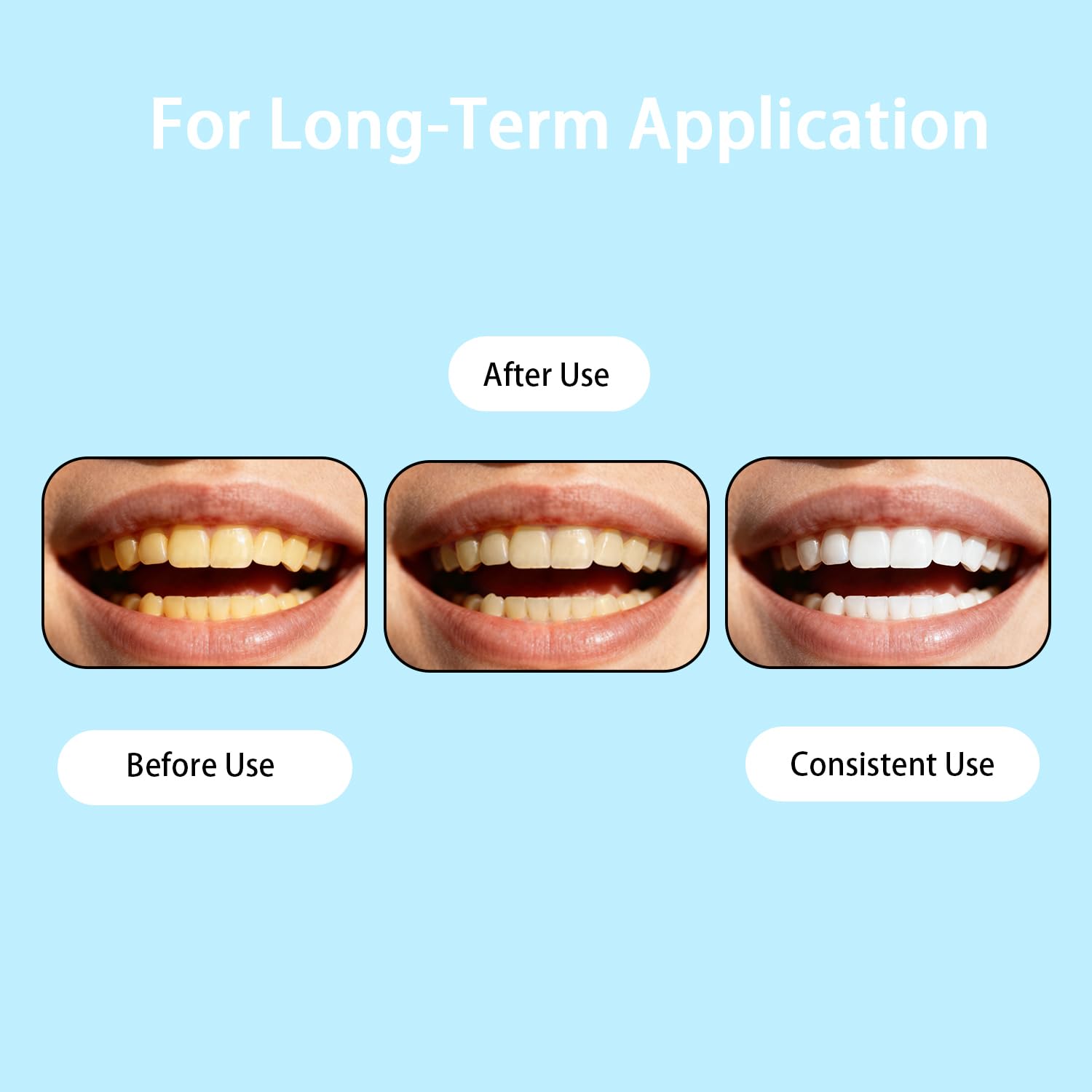Gum health support in daily oral care