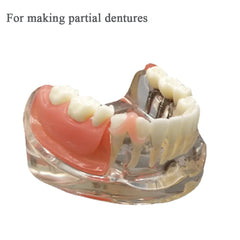 Close-up of gum adhesive tape for denture fitting