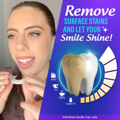 Step 2: applying tray to lower teeth and waiting 30-60 minutes