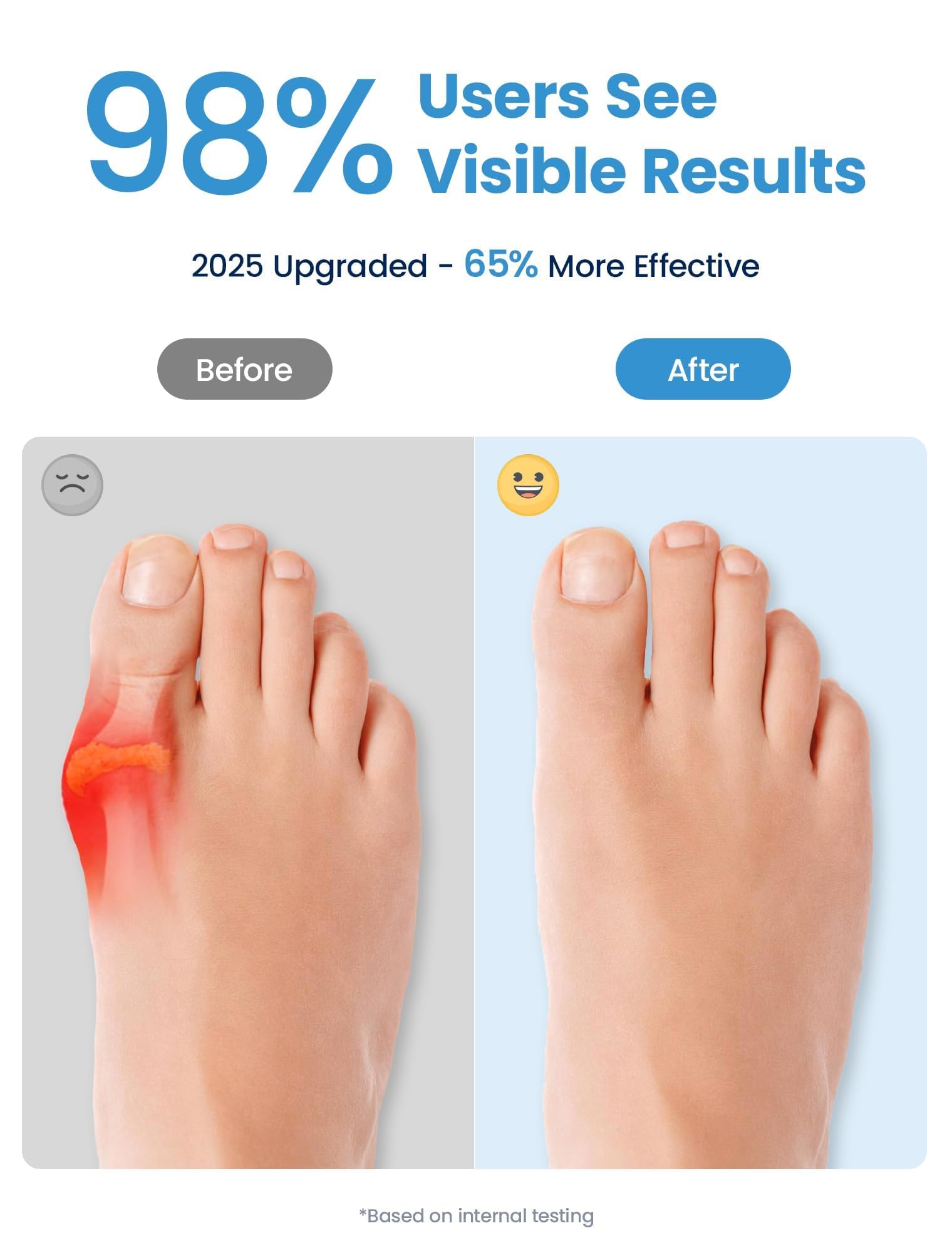 Habioer toe separators demonstrate natural big-toe alignment and reduced toe friction