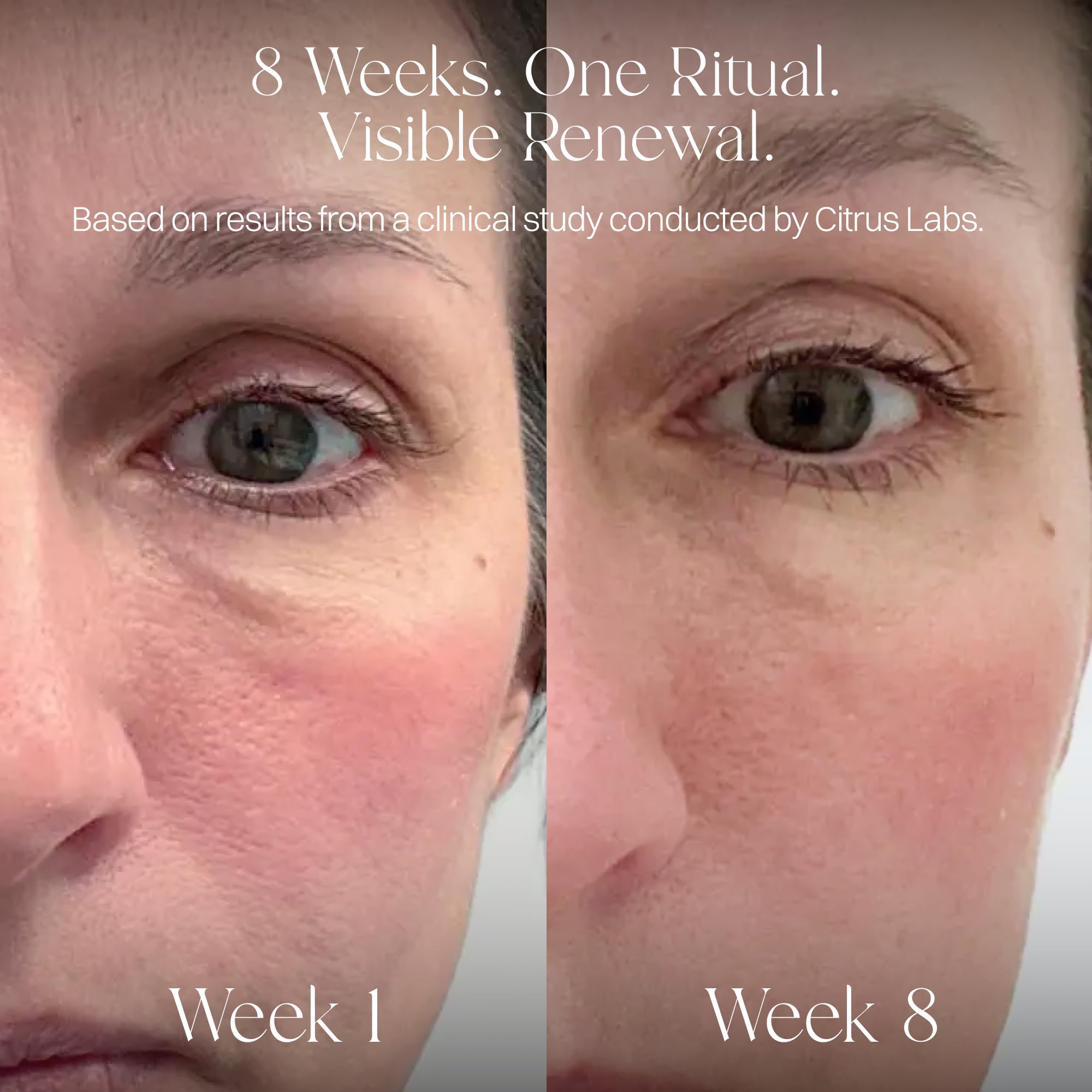 Vitamin C liposomal formulation