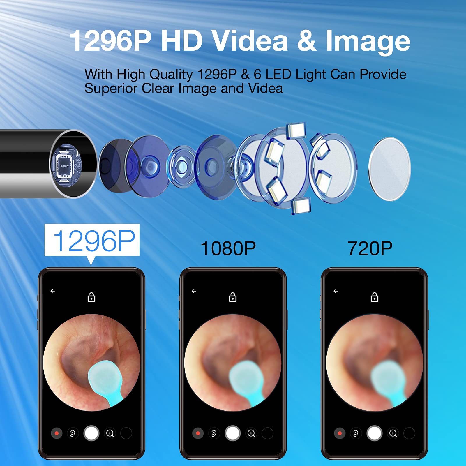 Hayiue 1296P FHD otoscope delivers crisp imagery for precise removal.