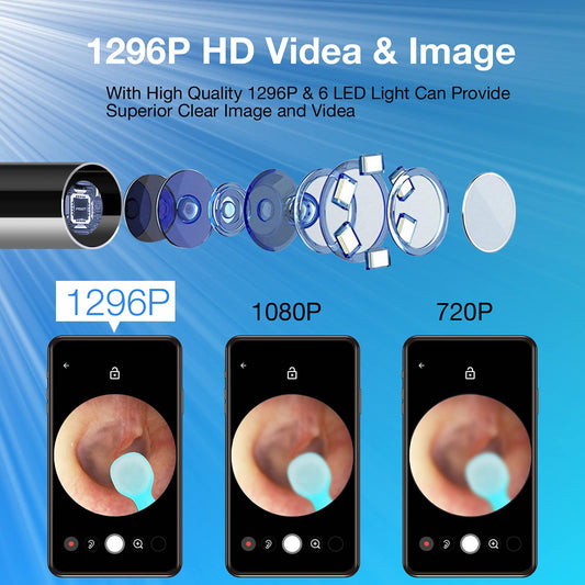 Hayiue 1296P FHD otoscope delivers crisp imagery for precise removal.