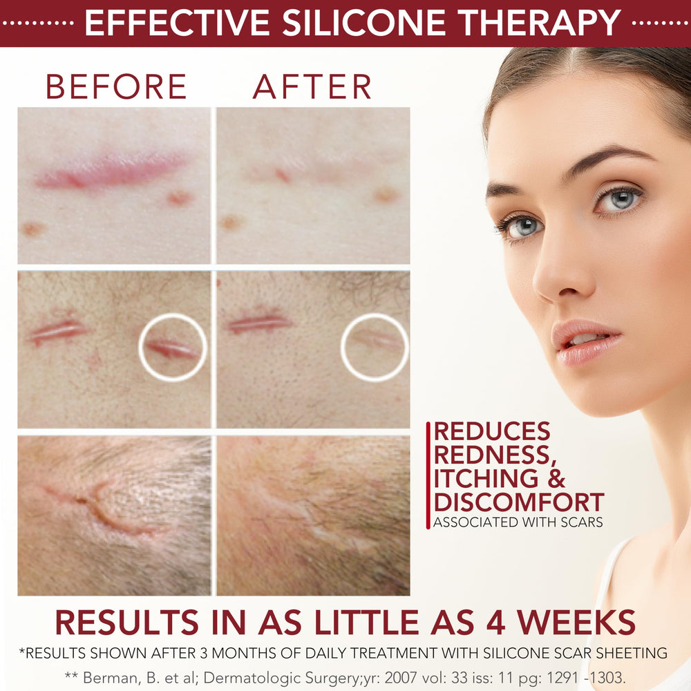 HealFast silicone scar gel application on skin demonstrating gentle spreading for healing.