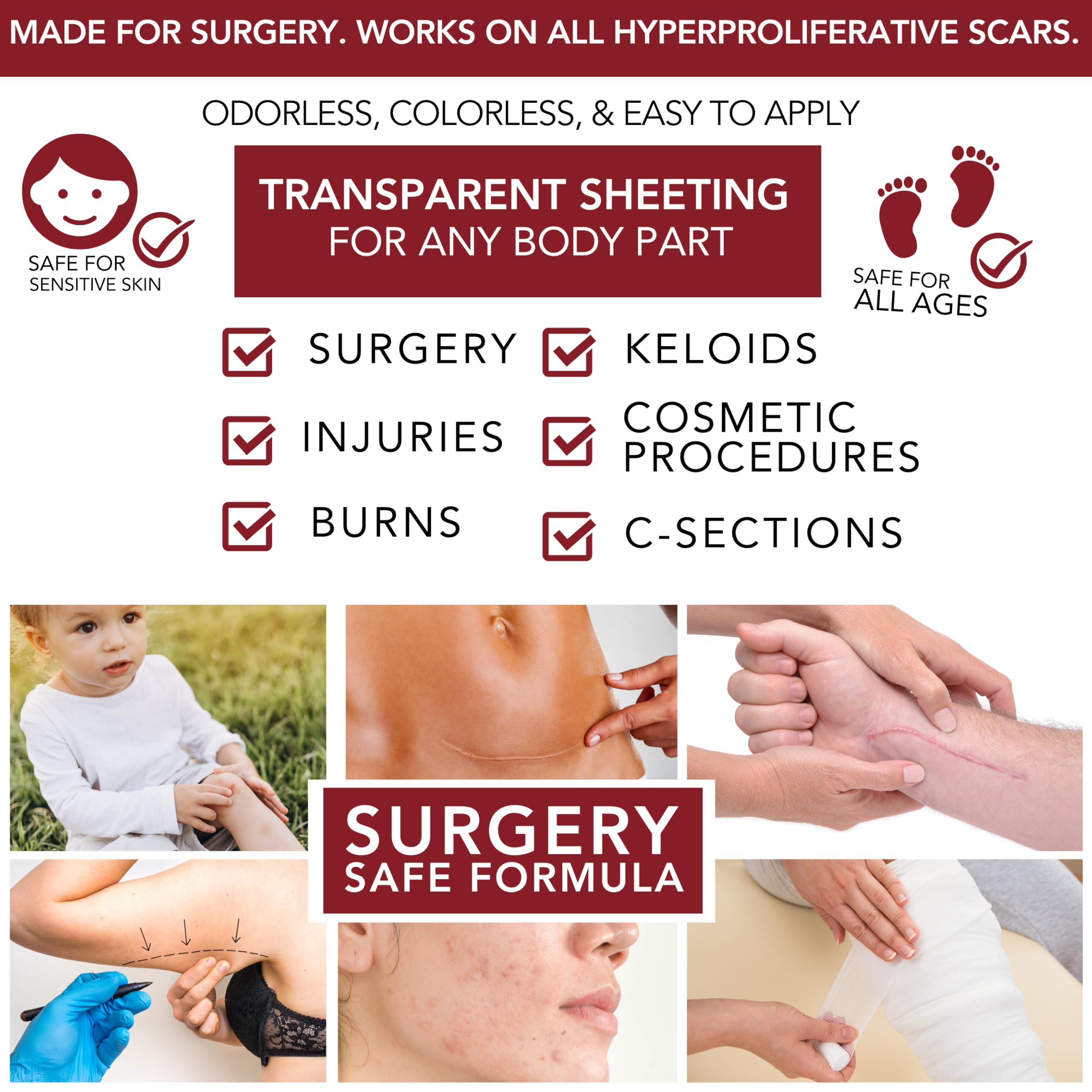 HealFast silicone scar gel sheets on skin illustrating multi-area use across face and body.