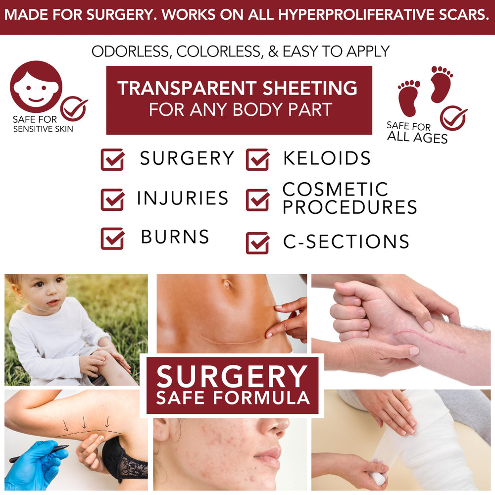 HealFast silicone scar gel sheets on skin illustrating multi-area use across face and body.