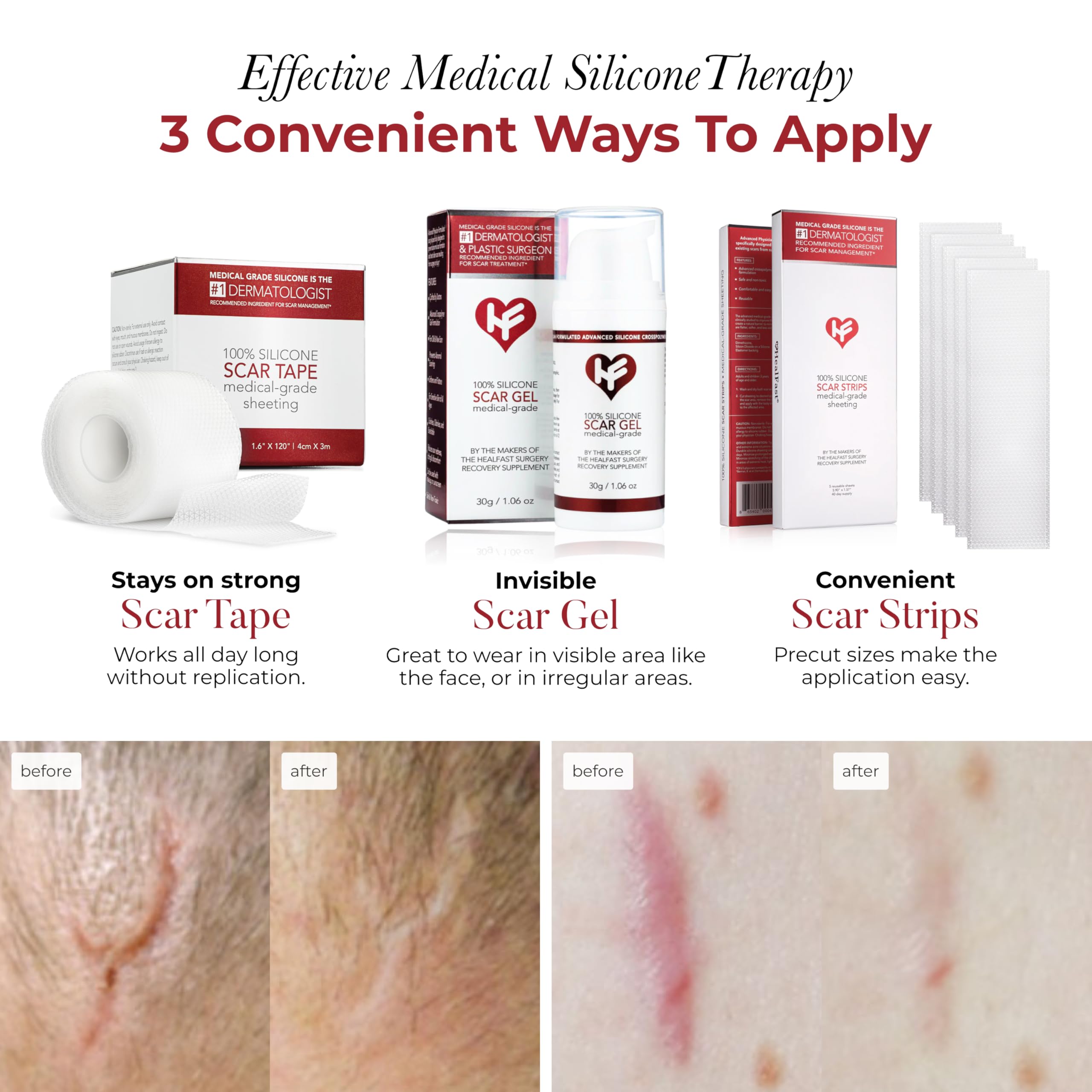 HealFast silicone scar sheets closeup highlights medical-grade material for gentle skin contact.