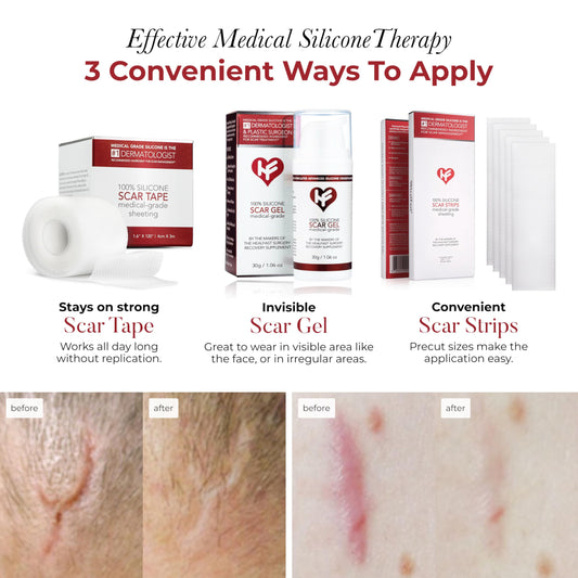 HealFast silicone scar sheets closeup highlights medical-grade material for gentle skin contact.