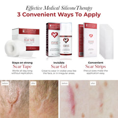 HealFast silicone scar sheets closeup highlights medical-grade material for gentle skin contact.