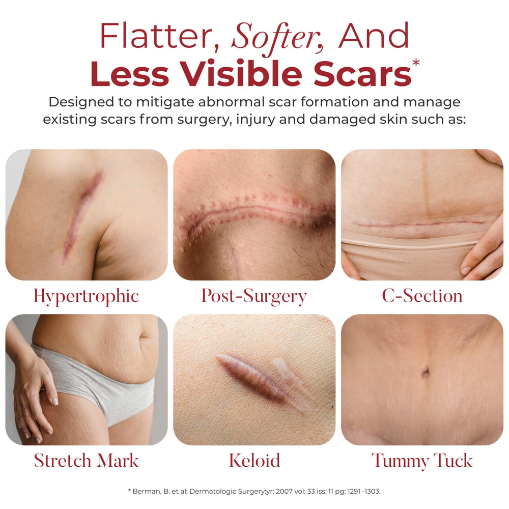 HealFast silicone scar sheets rolled-pack format emphasizes travel-friendly storage and replacement.