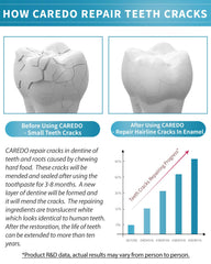 Graphic showing enamel repair concept