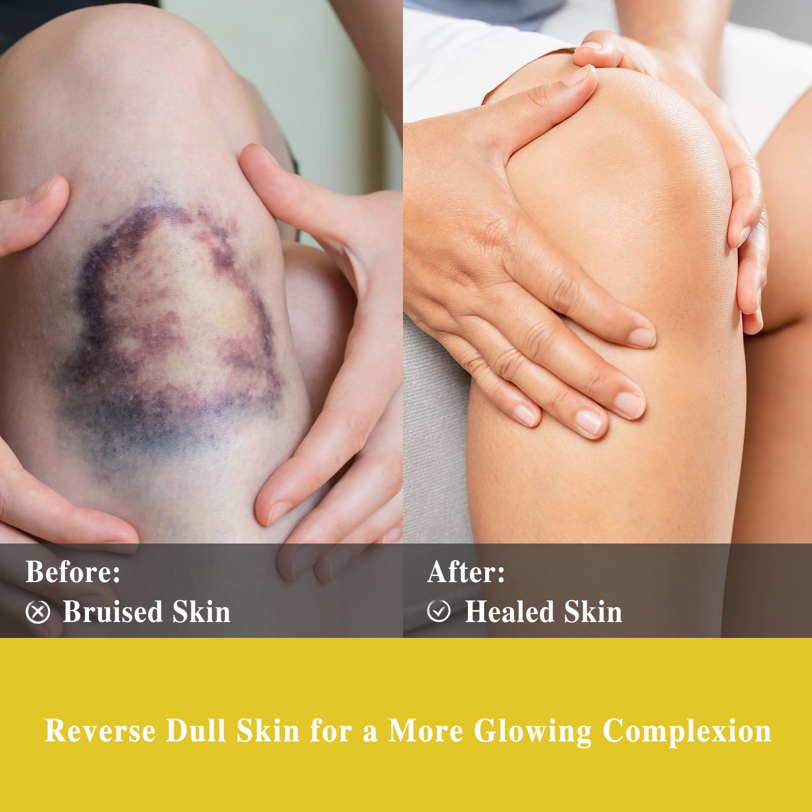 Elegant packaging of Helichrysum essential oil