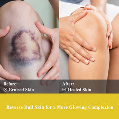 Elegant packaging of Helichrysum essential oil