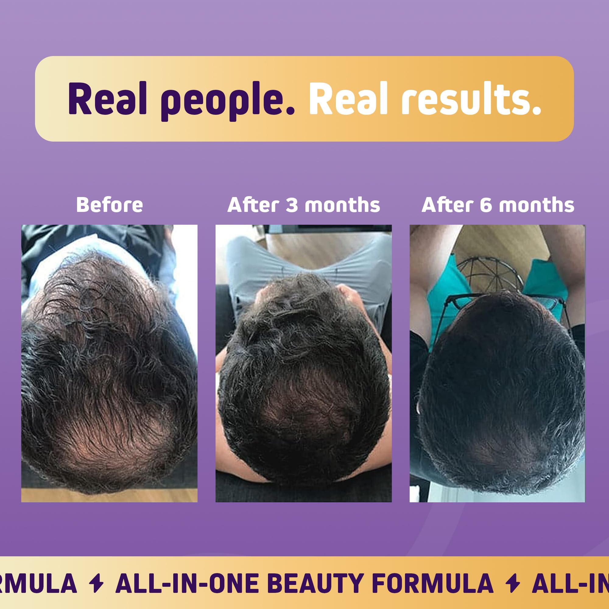 Illustration of healthy hair growth and vibrancy