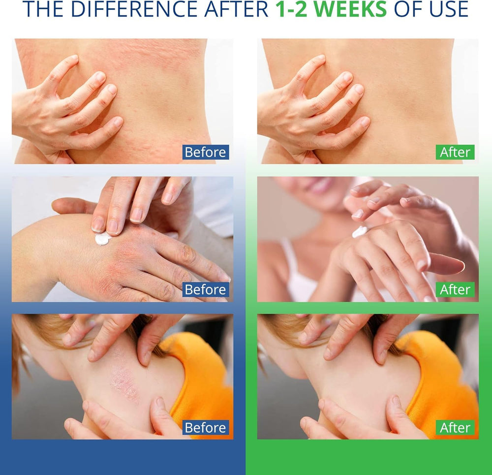 Hermon face-body-use-cream shown for all-over gentle skin care.