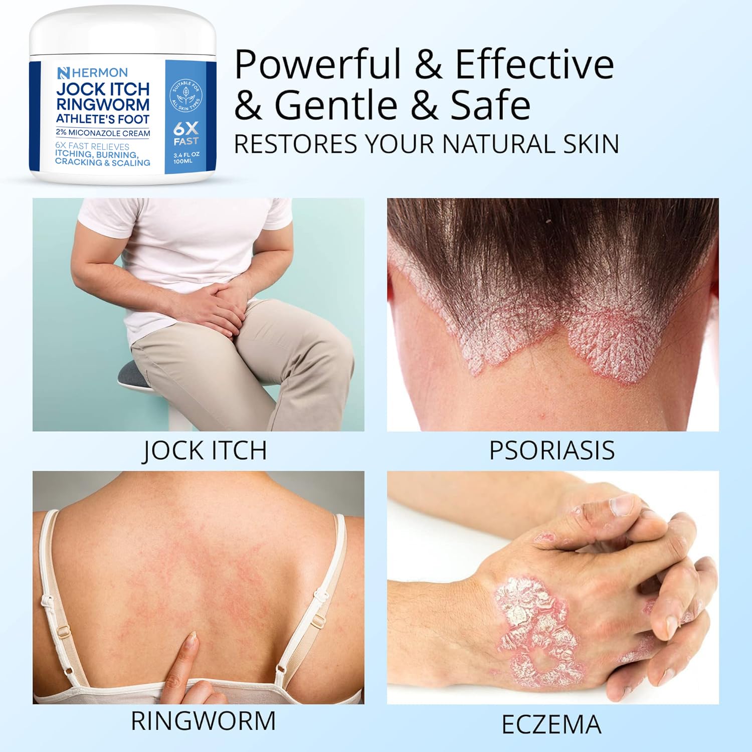 Hermon Ringworm Treatment ointment shows visible improvement while staying non-irritating.