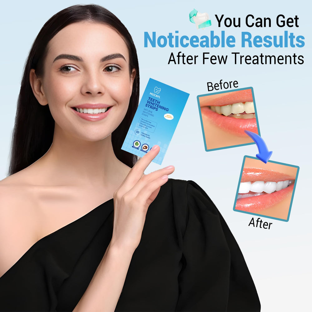 Huzayl Teeth Whitening Strips packaging and 28 strips