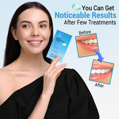 Huzayl Teeth Whitening Strips packaging and 28 strips