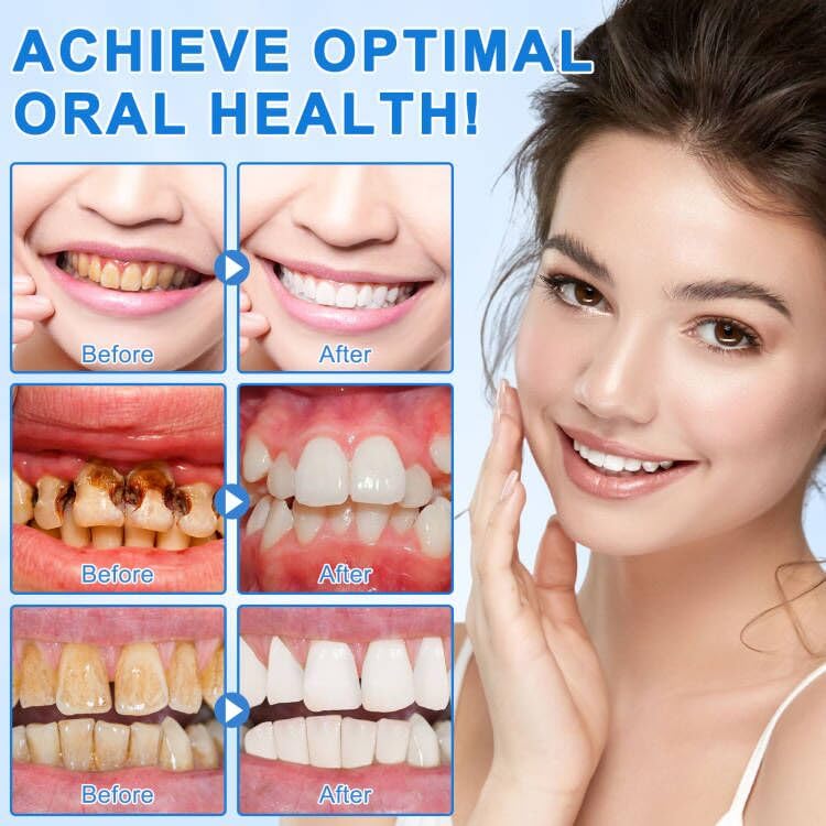 Enamel surface close-up with whitening impression