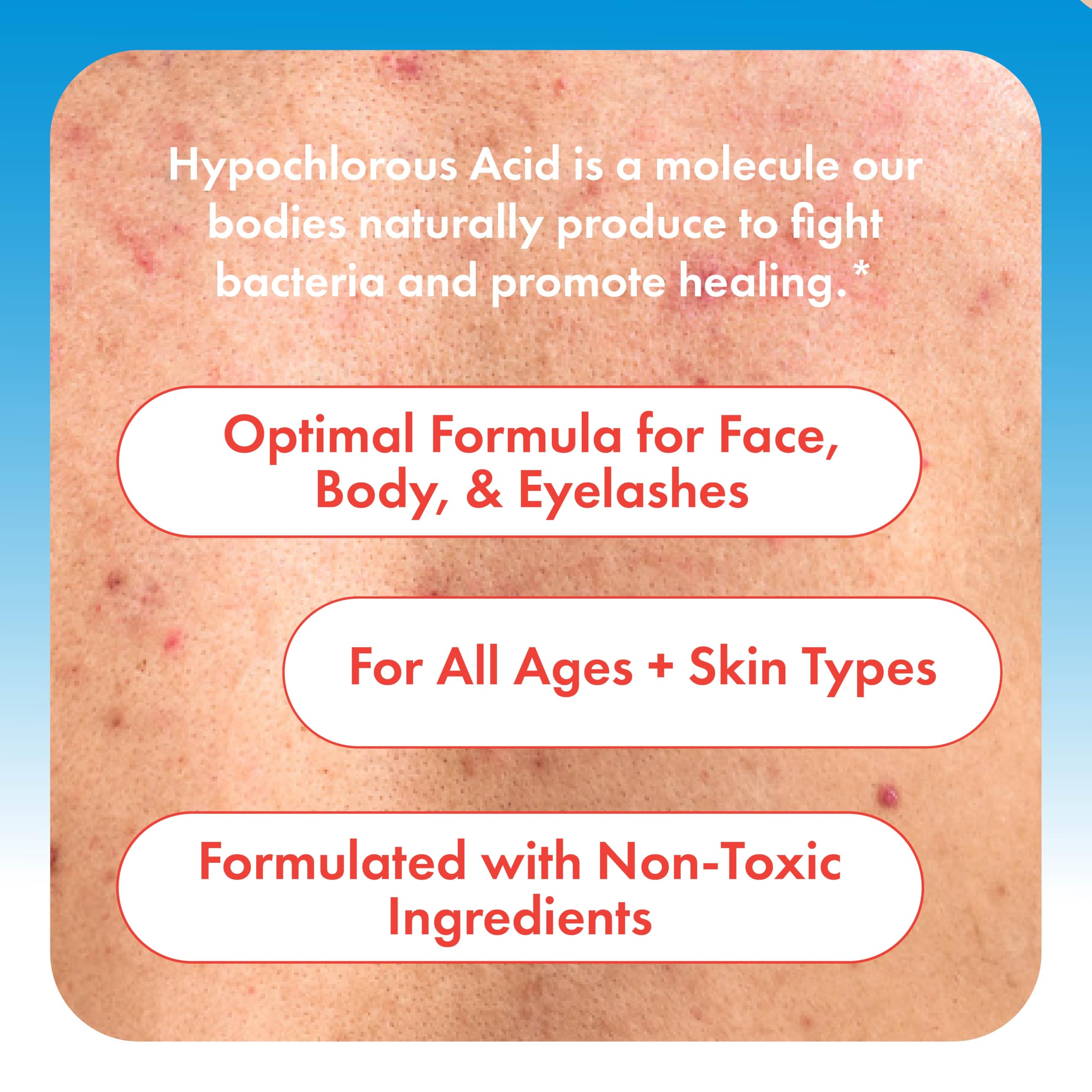 8 oz HypoClear bottle shown as travel-friendly skincare companion.