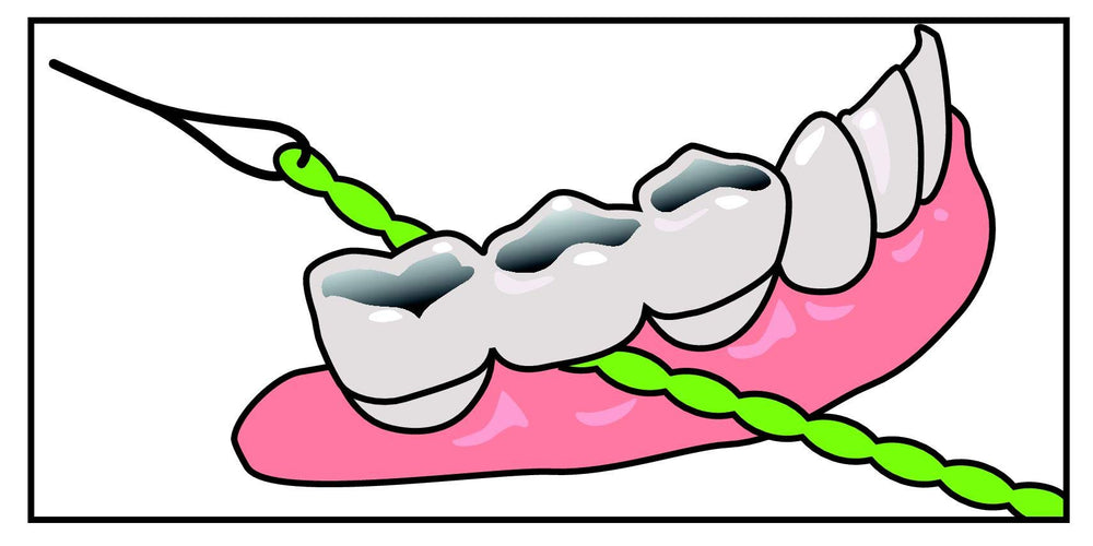 IDontix Brace X-Floss Green product image 4 – green floss close-up