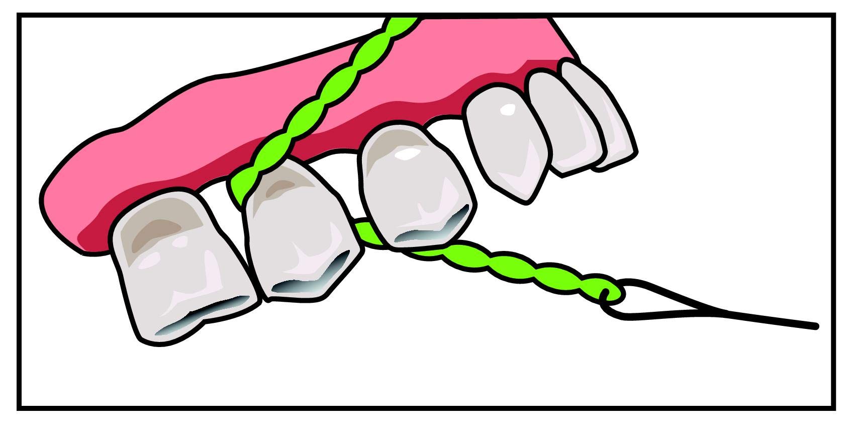 IDontix Brace X-Floss Green product image 6 – floss texture close-up