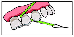 IDontix Brace X-Floss Green product image 6 – floss texture close-up
