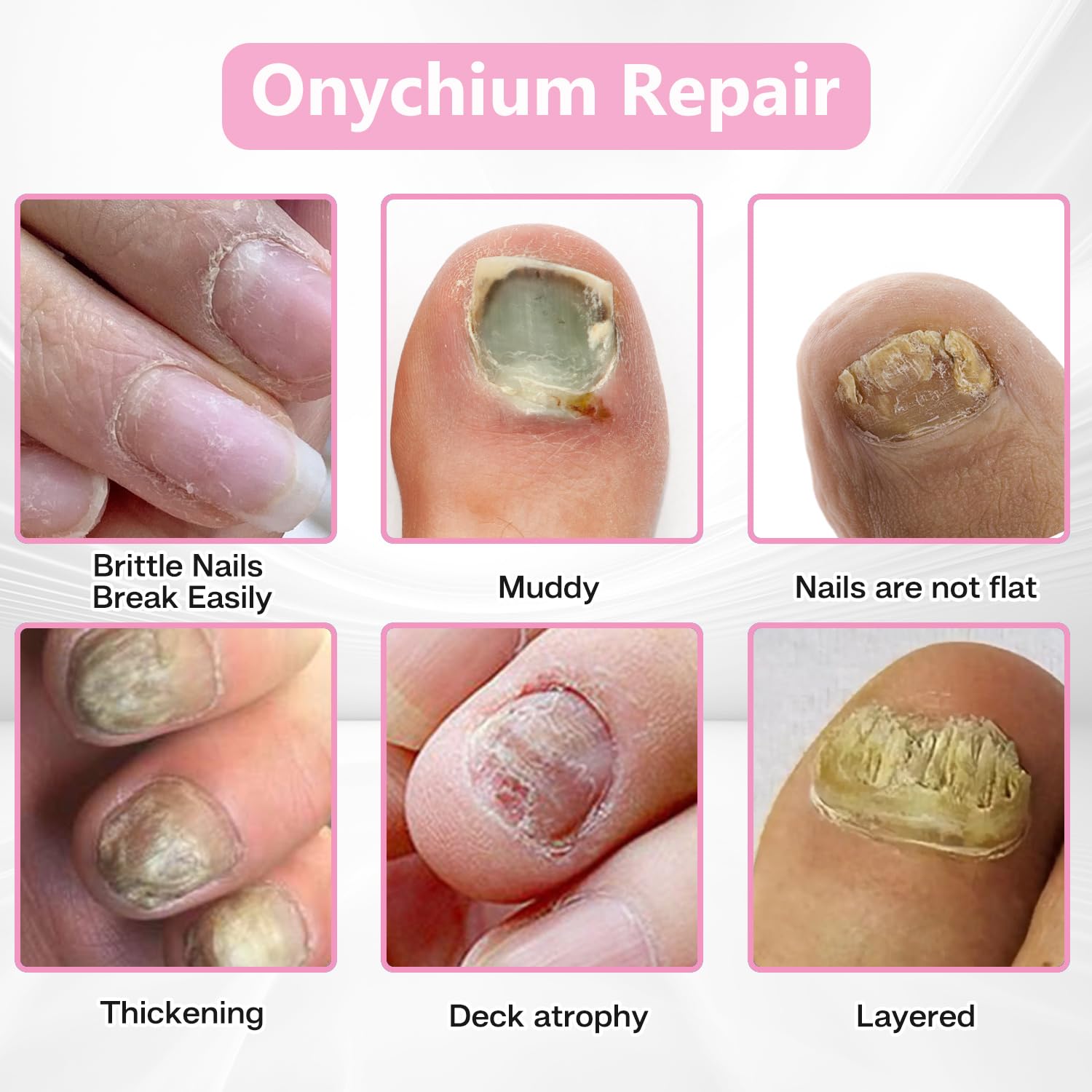 ILIORGOGO 60-count nail patches viewed to show ample supply for months