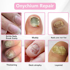 ILIORGOGO 60-count nail patches viewed to show ample supply for months