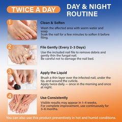 TEGASOLVE Toenail Fungus Treatment Extra Strength – 15% Undecylenic Acid Antifungal Solution (9 Pcs)