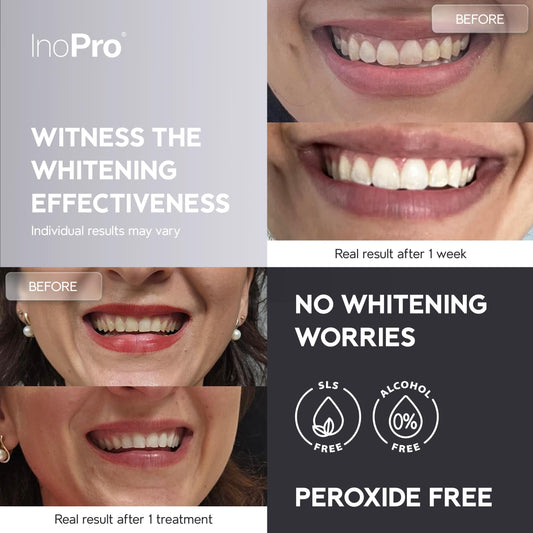 Close-up of InoPro whitening strips for sensitive teeth