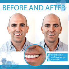 Jar of Instant Smile replacement beads included in the Deluxe Pack.